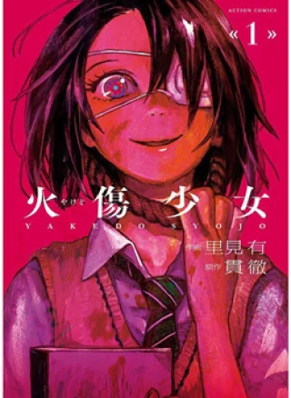 Yakedo Shoujo